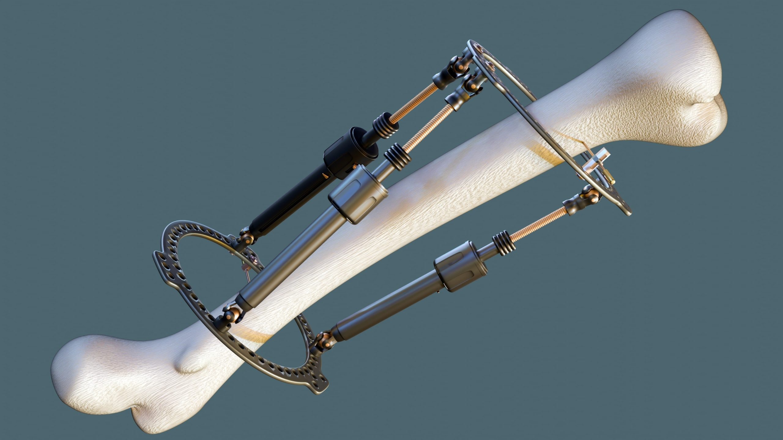 Limb Length Discrepancy Clifton, NJ